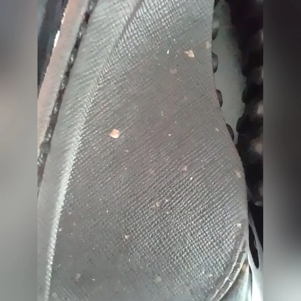 UGG Clog Tooth Toggle Shearlings - Picture 6 of 11